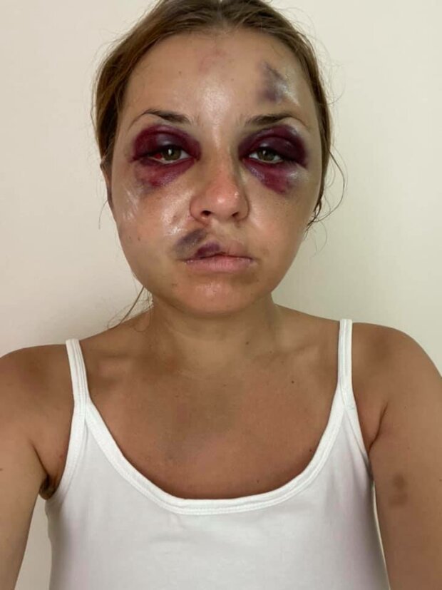 Жертва нападу у потязі