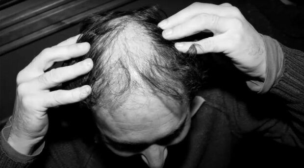 Лысая голова